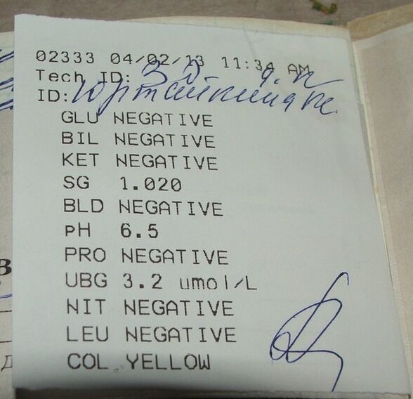 Mano šlapimo analizė atsiranda prieš moterišką